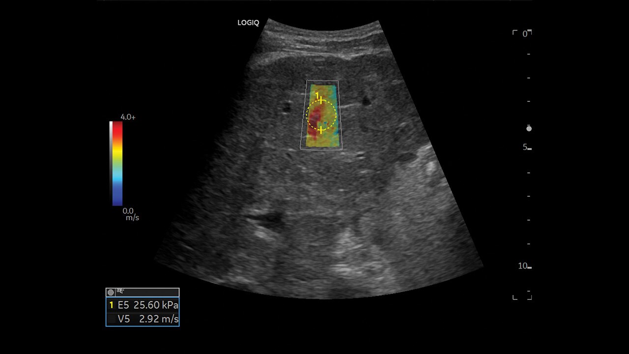 Product Media Carousel Image