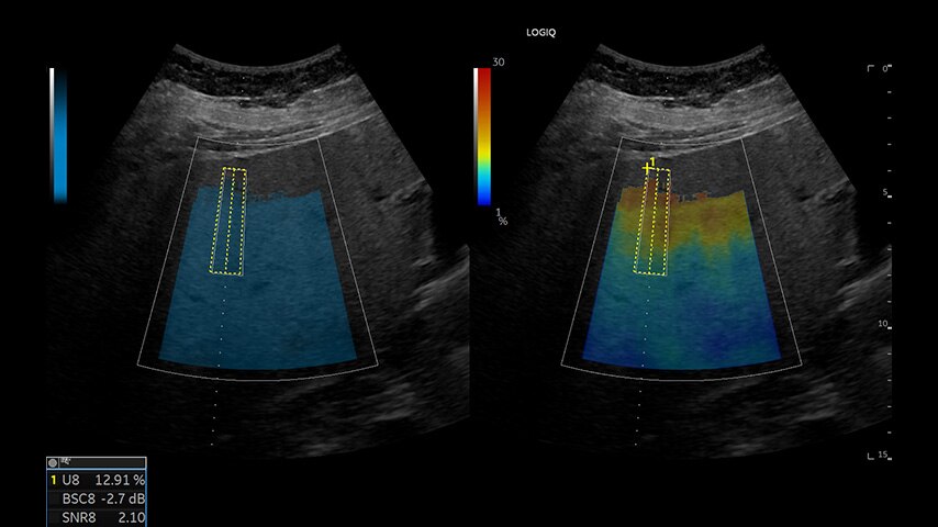 Product Media Carousel Image