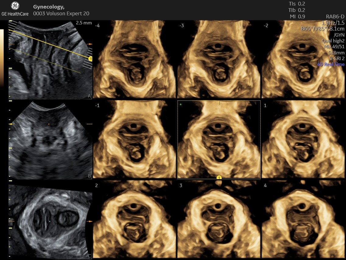 Product Media Carousel Image